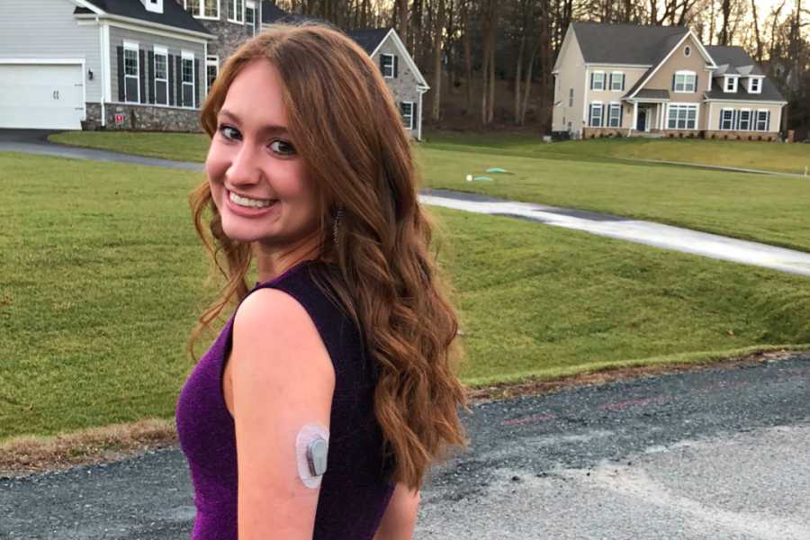 Lauren Gempp with her Dexcom, a continuous glucose monitor. The device sends her blood sugar to her phone every five minutes.